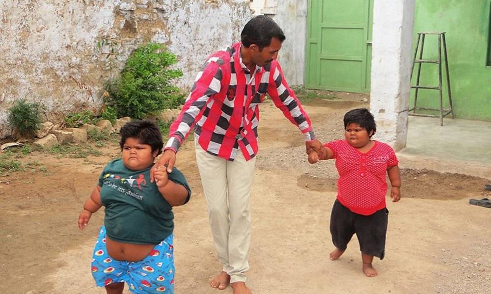 طفلتان هنديتان تمشيان لأول مرة بعد معاناة مع السمنة المفرطة