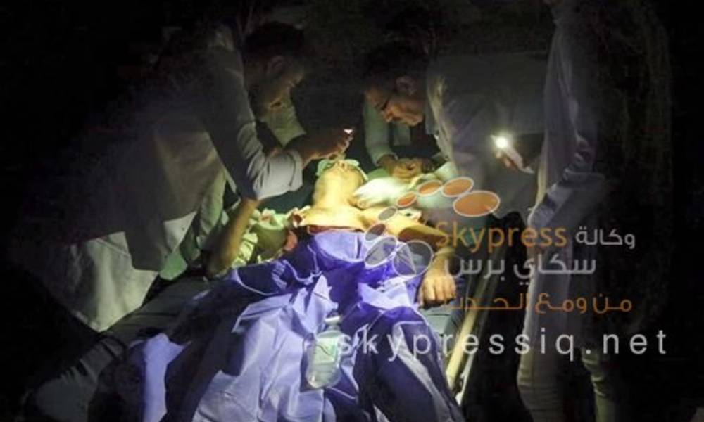 بالصورة... لأول مرة عملية جراحية على مصباح الموبايل في العراق