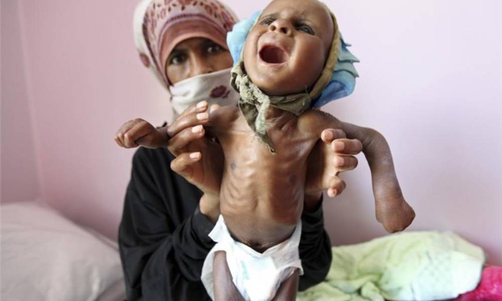 منظمات دولية: 19 مليون شخص يعانون من المجاعة في اليمن