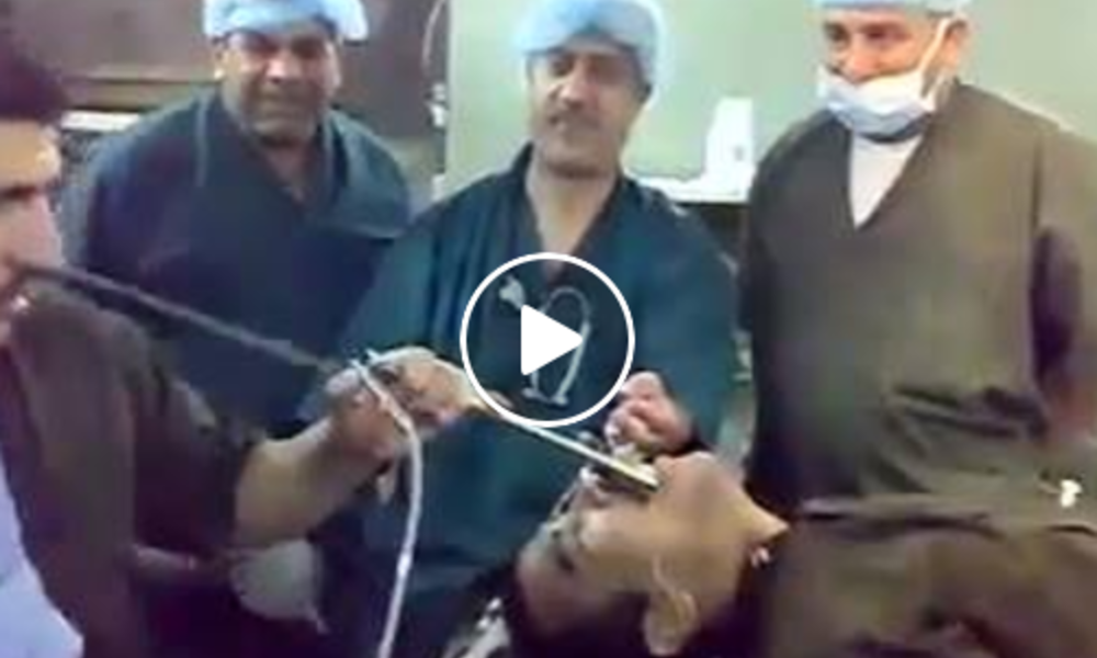 بالفيديو.. طبيب يخرج "سبانة"من معدة احد المرضى