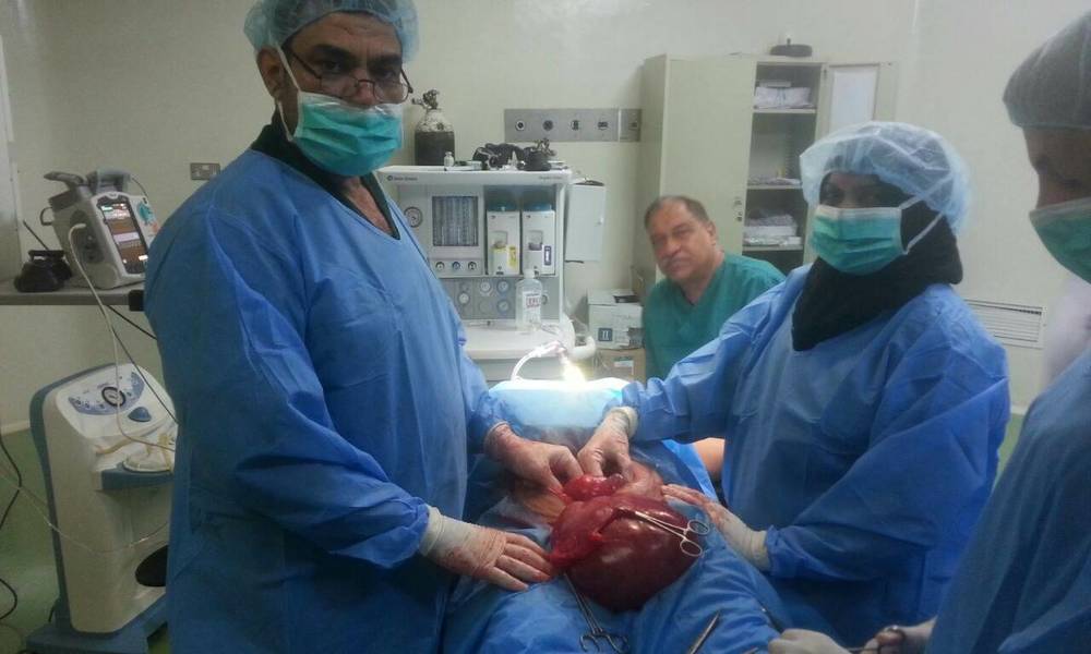 بالصور ...فريق طبي ينجح في استئصال ورم وزنه (4) كغم من رحم خمسينية في بغداد