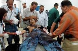 جرح ثلاثة طلاب بسقوط قذائف هاون في ابوغريب