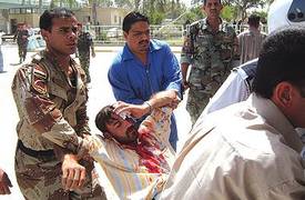 اصابة مدنيين اثنين بتفجير لاصقة في مدينة الصدر شرقي بغداد