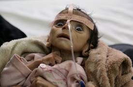 50 ألف طفل يمني معرضون للموت بنهاية 2017 بسبب الحصار السعودي