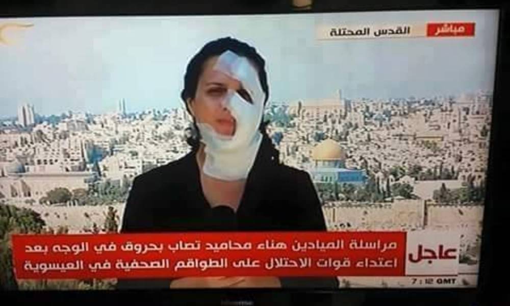 بالفديو... اصابة مراسلة قناة الميادين اثناء البث المباشر