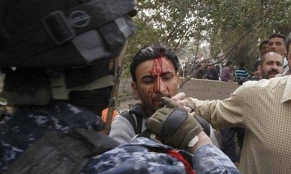 حماية وزير الصحة  يتعدون على  صحفيين في بابل بالضرب "المبرح"
