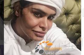 شاهد بالصورة ... الشاذ شقيق الفنانة احلام