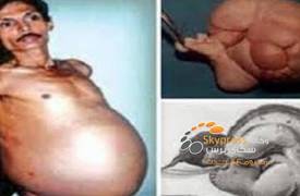"رجل حامل" بالهند.. والسبب نادر لا يخطر على البال!