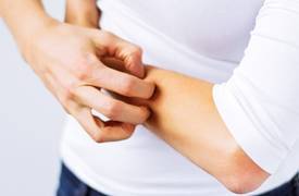 احذروا لدغة البعوضة .. و السبب ؟