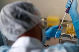 وزارة الصحة ..تسجيل 150 اصابة جديدة بفيروس كورونا في العراق